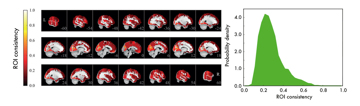Distribution of consistency for ROIs as brain network nodes